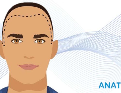 Importance d’identifier la Racine des Cheveux 